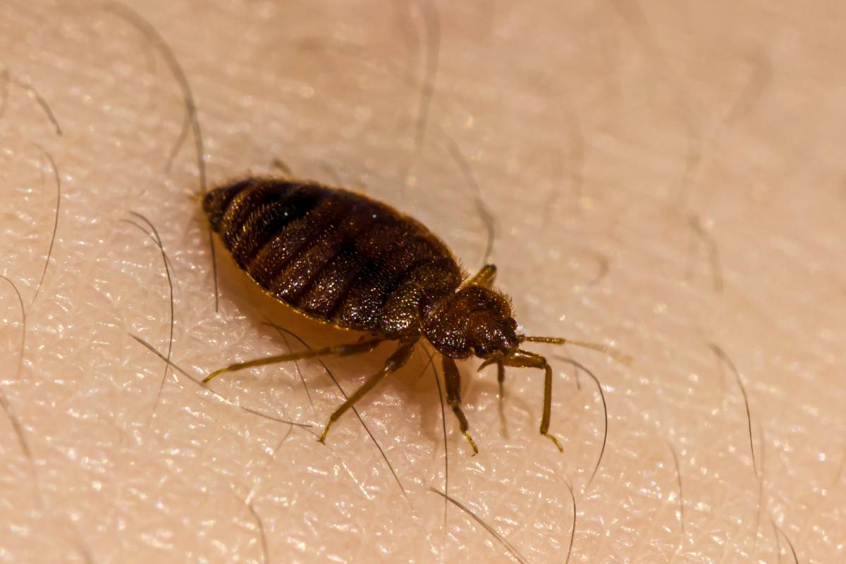 cimice sulla pelle